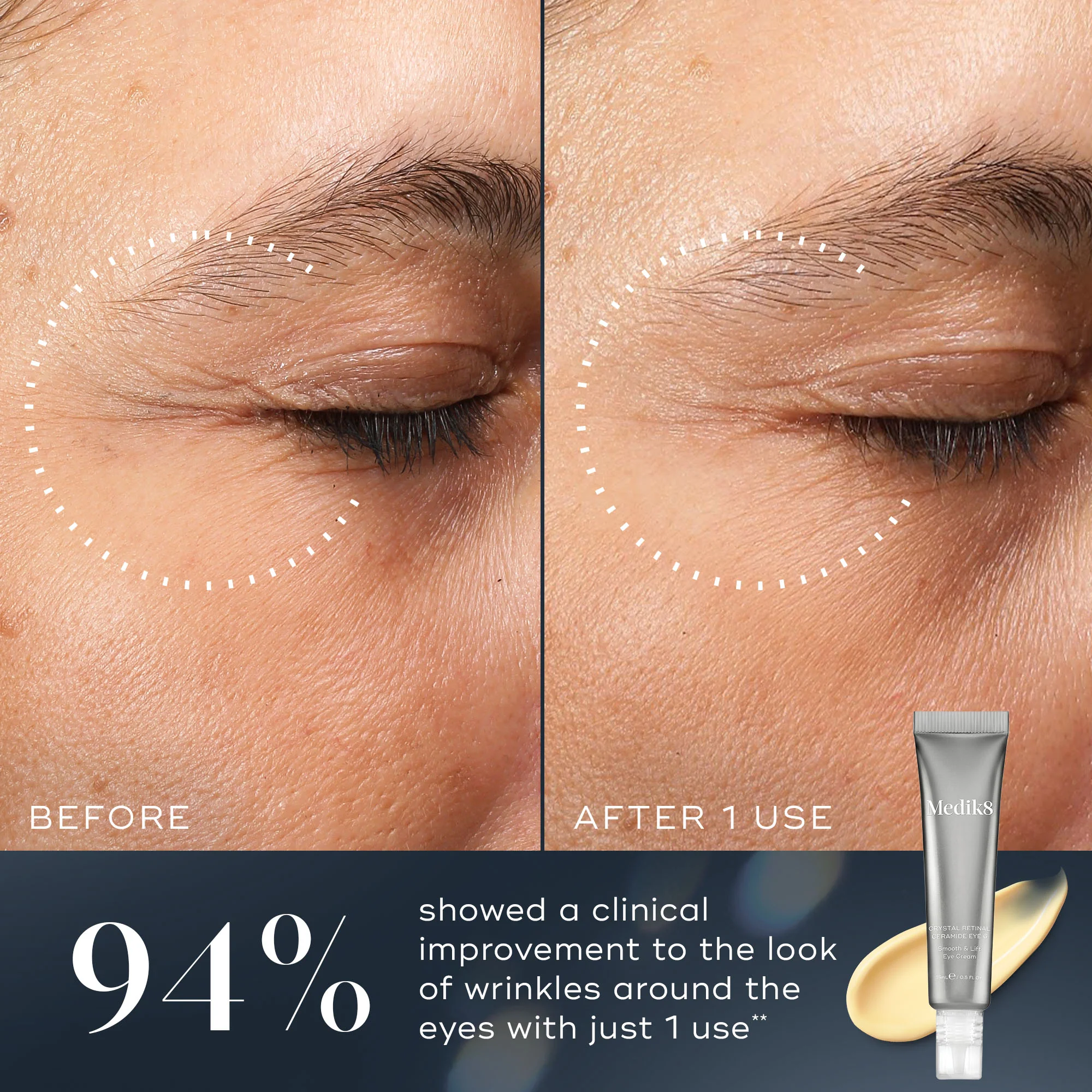 Crystal Retinal® Ceramide Eye - Image 5