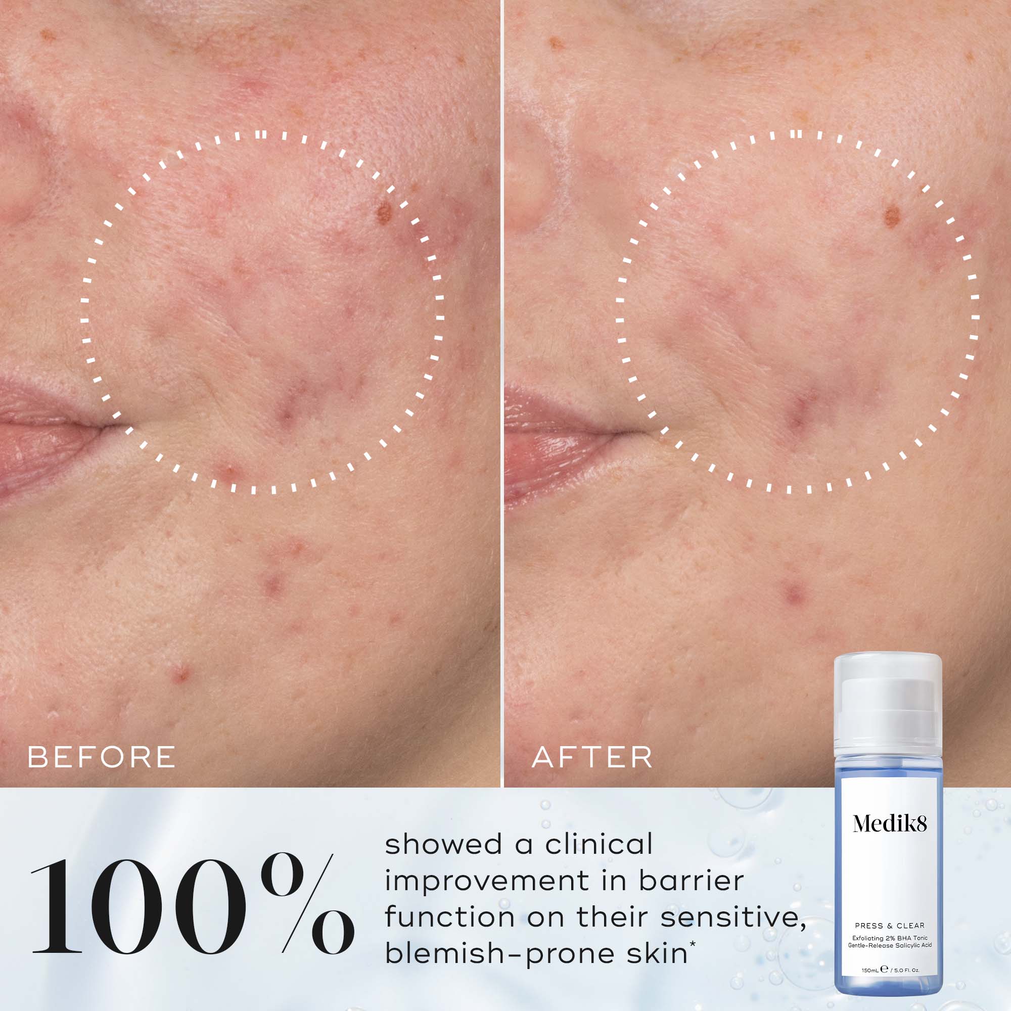 Press & Clear™ (Travel Size) - Image 4